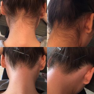 1779178b-a657-4e81-9d98-852b6ee44c14